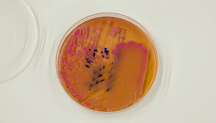 Bacillus Cereus Sayımı